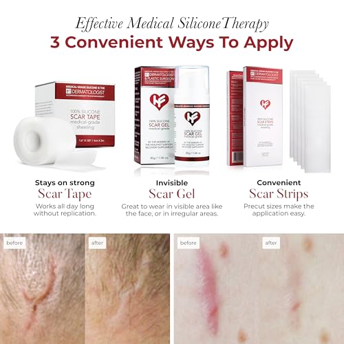 Physician Formulated Silicone Scar Sheets - Advanced Crosspolymer Medical Grade Silicone Scar Tape for Surgery, C Section, Keloids & Hypertrophic Scars - Silicone Tape For Scars - Scar Patches