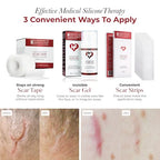 Physician Formulated Silicone Scar Sheets - Advanced Crosspolymer Medical Grade Silicone Scar Tape for Surgery, C Section, Keloids & Hypertrophic Scars - Silicone Tape For Scars - Scar Patches
