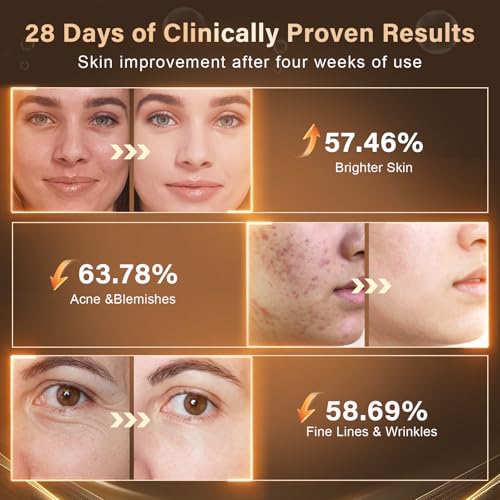 Red Light Therapy for Face, LED Face Mask Light Therapy, 5 Light Modes, 432 High-Density Light Beads, Red Light Therapy Mask for Acne, Wrinkles, Skin Rejuvenation, Professional Home Skincare
