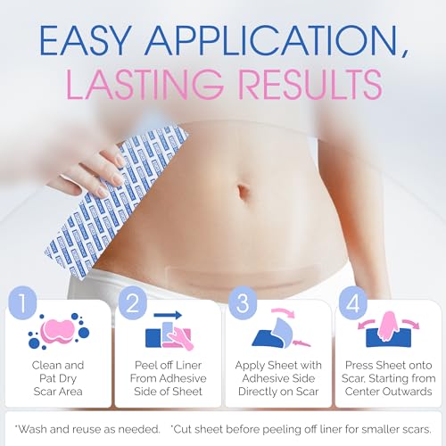 C Section Scar Silicone Strips for Surgical Scars, Tummy Tuck, C Section Recovery Must Haves - Silicone Scar Sheets - Large 7 inch, 8 Reusable Strips