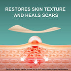 Silicone Scar Sheets,Tape, Strips - Healing Keloid, C-Section and Tummy Tuck - As Surgical Cream, Gel, Patch, Bandage, Pad - Surgery Scars Treatment - 6 Pack