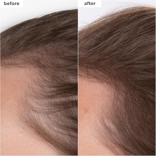 Briogeo Destined For Density MegaStrength+ Caffeine + Biotin Peptide Density Serum, Increases Hair Thickness and Density, Fast-Absorbing & Non-Greasy, Fragrance-Free, Vegan, Cruelty-Free, 1.5 fl oz