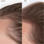 Briogeo Destined For Density MegaStrength+ Caffeine + Biotin Peptide Density Serum, Increases Hair Thickness and Density, Fast-Absorbing & Non-Greasy, Fragrance-Free, Vegan, Cruelty-Free, 1.5 fl oz