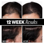 IGK Sponsored - Scalp Treatment for Hair Growth – Hair Thickening Serum for Women – Promotes Fuller, Thicker Hair – Scalp Serum for Hair Density and Thinning - 2.1oz