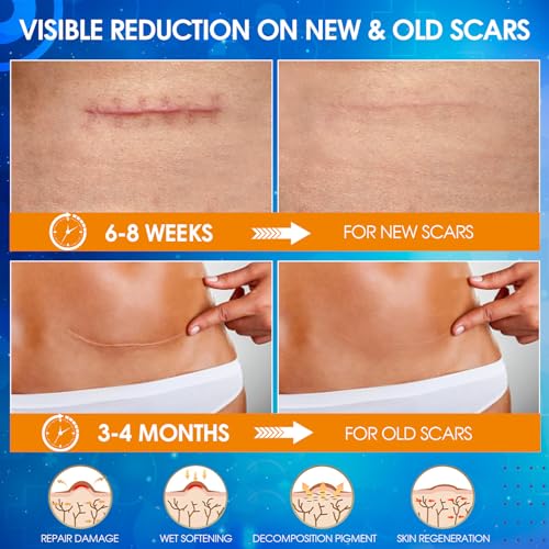 Silicone Scar Sheets (1.6" X 120" Roll), Medical Grade Silicone Scar Tape, Soft Silicone Scar Patches for Surgical Scars, C Section, Keloid, Tummy Tuck, Burn
