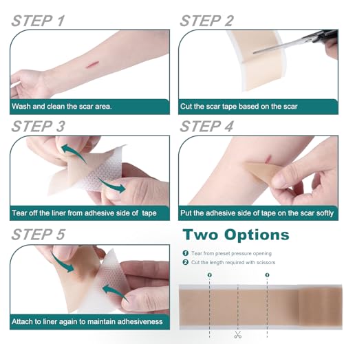 Silicone Scar Sheets (1.6"x 158" Roll-4M), Silicone Scar Tape for Scar Removal Treatment, Reusable Silicone Scar Strips for C-Section, Keloid, Burn, Acne, Surgical Scars