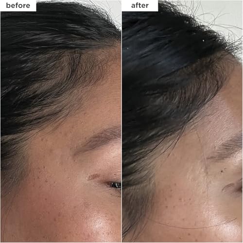 Briogeo Destined For Density MegaStrength+ Caffeine + Biotin Peptide Density Serum, Increases Hair Thickness and Density, Fast-Absorbing & Non-Greasy, Fragrance-Free, Vegan, Cruelty-Free, 1.5 fl oz