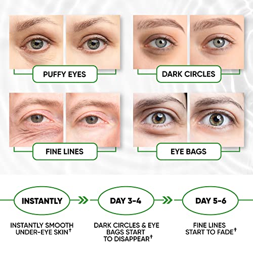 Under Eye Patches for Puffy Eyes, Dark Circles, Undereye Bags - Green Tea Skincare Treatment Mask for Wrinkles, Puffiness Reducer - Hyaluronic Acid, Collagen,Caffeine - Gifts for Women & Men - 60 Pads