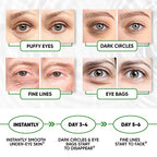 Under Eye Patches for Puffy Eyes, Dark Circles, Undereye Bags - Green Tea Skincare Treatment Mask for Wrinkles, Puffiness Reducer - Hyaluronic Acid, Collagen,Caffeine - Gifts for Women & Men - 60 Pads
