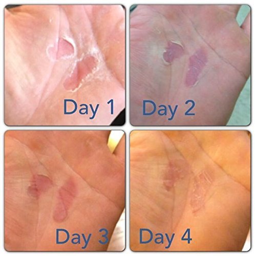Hand Tear Repair - Rip Fix Stopper Balm for Gymnastics - Climbers Hand Balm - Wod Callus Hand Care - Climbing Hand Repair Balm Cream - Treatment for Cracked or Ripped Hands Classic 1.34 oz Tin