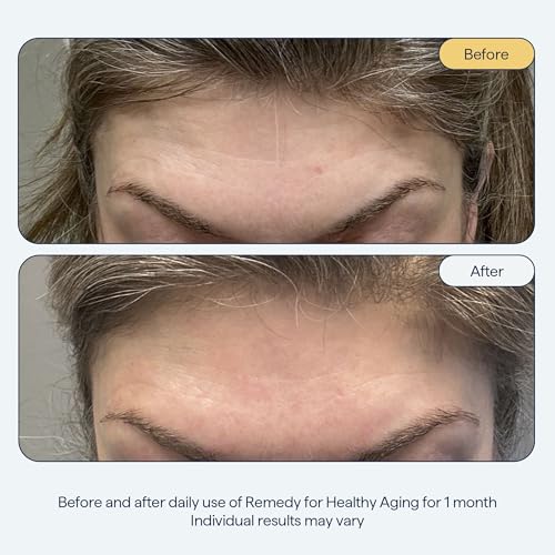 Remedy for Healthy Aging - Anti-Aging Treatment for Wrinkles, Uneven Texture & Tone with Retinaldehyde, Argireline, Matrixyl 3000, Glycolic Acid, Ferulic Acid - By Dermatologist Dr. Shah