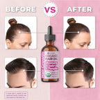 USDA Organic Rosemary Hair Oil for Hair Growth 4oz - Cold Pressed & Hexane Free Blend of Castor, Pumpkin Seed, Peppermint & Jojoba Oils - Thickening & Strengthening Hair Loss Treatment for Women & Men