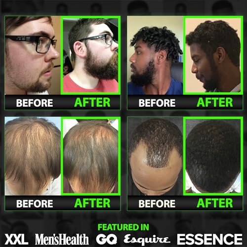GROW Maximum XXL Hair & Beard Growth Oil For Men • Beard Growth Serum That Fills Patches & Fix Thinning GUARANTEED • Facial Hair & Scalp Treatment • Thickening Conditioner & Enhancer • Made in the USA