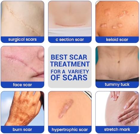 Silicone Scar Sheets Surgical Tape (1.6”x120” Roll) Face Patches Acne Treatment C Section Strips, Skin-Sensitive Medical Grade Healing Scar Bandages Pads for Keloid, Stretch and Tummy Tuck Recovery