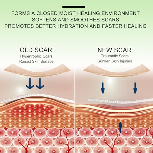 Silicone Scar Sheets, Clear Silicon Gel Scar Sheets, Invisible Scar Tape(1.6” x 120”Roll-3M), Scar Strips for Surgical Scars, Medical Grade, Scar Removal Sheets for C-Section, Breast, Keloid et.