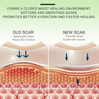 Silicone Scar Sheets, Clear Silicon Gel Scar Sheets, Invisible Scar Tape(1.6” x 120”Roll-3M), Scar Strips for Surgical Scars, Medical Grade, Scar Removal Sheets for C-Section, Breast, Keloid et.