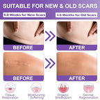 Silicone Scar Sheets, Medical Grade Silicone Scar Tape (1.6" x 120"), Professional Scar Removal Treatment, Reusable, for Healing Keloids, Surgeries Scars, C-sections, and Burns