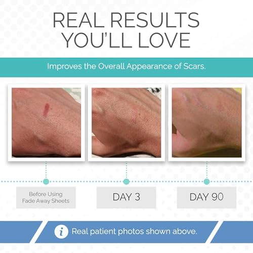 Fade Away Scars - Original Silicone Scar Sheeting Roll- Custom Size Medical Grade- Effective Silicone Scar Sheets, Strips and Patches for Scars, Surgical Scar Tape, Silicone Scar Sheets.