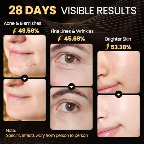 Red Light Therapy for Face, Enhance LED Face Mask Light Therapy for Acne, Wrinkles & Skin Rejuvenation, 3 Light Modes & Timing Settings, Eye Protection, Portable LED Face Mask Home Skincare