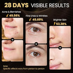 Red Light Therapy for Face, Enhance LED Face Mask Light Therapy for Acne, Wrinkles & Skin Rejuvenation, 3 Light Modes & Timing Settings, Eye Protection, Portable LED Face Mask Home Skincare
