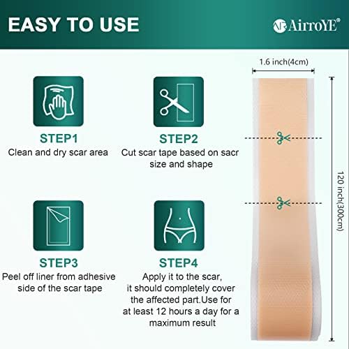 Silicone Scar Sheets, Silicone Scar Tape (1.6"x 120" Roll-3M), Reusable and Effective Scar Removal Sheets, Silicone Scar Removal Sheets for Surgical Scars, Healing Keloid, C-Section, Tummy Tuck