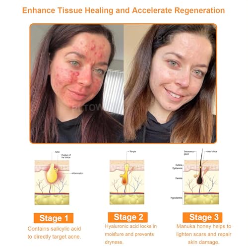 BBOJI 7-Day Multi-Effect All-in-One Skincare Cream, 2025 New Professional Bee Venom Cream, BOJI Bee Venom Skin Treatment Cream, Repair, moisturize and lift 3 in 1, for All Skin Types (1 Bottle)