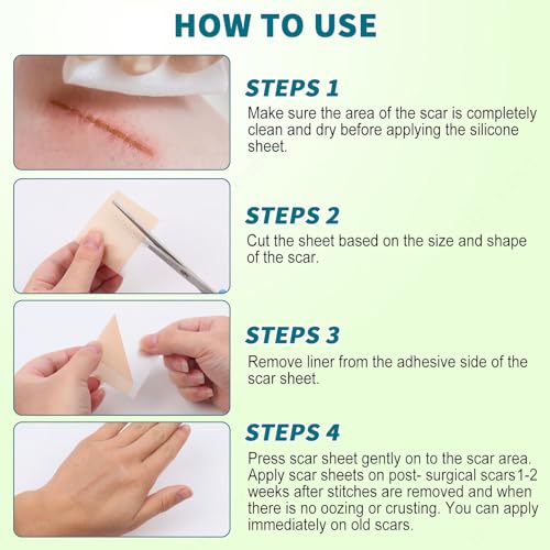 Silicone Scar Sheets, Silicone Scar Tape, Scar Sheets for Surgical Scars, Reusable Silicone Scar Strip For Surgical, C-Section,Tummy Tuck, Keloid Scars, Burn, Acne, Removal (1.6"X 108" Roll-3M)