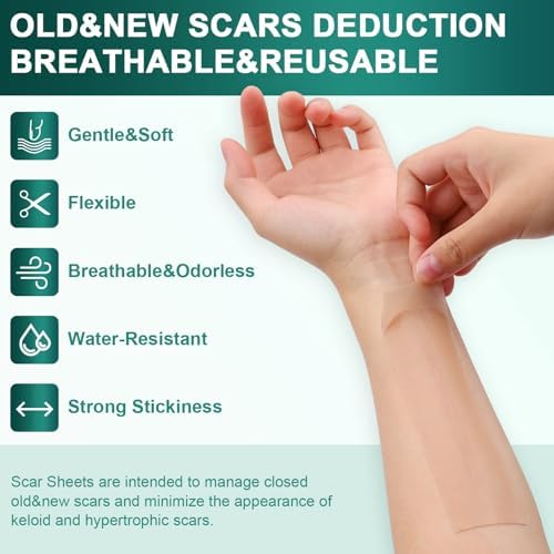 Silicone Scar Sheets, Silicone Scar Tape (1.6"x 120" Roll-3M), Reusable and Effective Scar Removal Sheets, Silicone Scar Removal Sheets for Surgical Scars, Healing Keloid, C-Section, Tummy Tuck