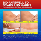 1.6"x 60" Medical Silicone Scar tape for Scars: Medical Grade Scar Sheets Reduces the Appearance of Scars from surgical Acne Stitches Burns More