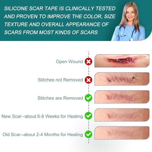 Silicone Scar Sheets (1.6"x 158" Roll-4M), Silicone Scar Tape for Scar Removal Treatment, Reusable Silicone Scar Strips for C-Section, Keloid, Burn, Acne, Surgical Scars