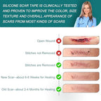 Silicone Scar Sheets (1.6"x 158" Roll-4M), Silicone Scar Tape for Scar Removal Treatment, Reusable Silicone Scar Strips for C-Section, Keloid, Burn, Acne, Surgical Scars