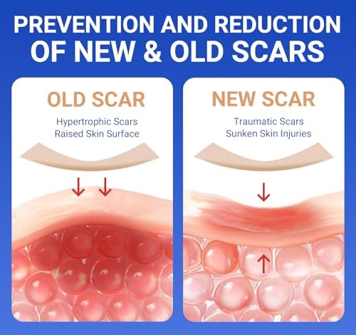 Silicone Scar Sheets Surgical Tape (1.6”x120” Roll) Face Patches Acne Treatment C Section Strips, Skin-Sensitive Medical Grade Healing Scar Bandages Pads for Keloid, Stretch and Tummy Tuck Recovery