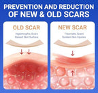 Silicone Scar Sheets Surgical Tape (1.6”x120” Roll) Face Patches Acne Treatment C Section Strips, Skin-Sensitive Medical Grade Healing Scar Bandages Pads for Keloid, Stretch and Tummy Tuck Recovery