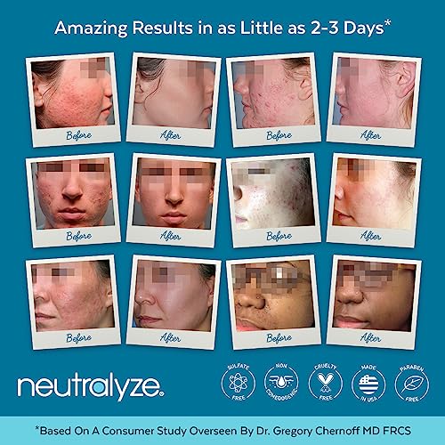 Exfoliating Acne Treatment Pads - 100 Dual Textured Face Wipes with 2% Salicylic Acid & 2% Mandelic Acid - Toner Pads for Acne Prone Skin, Face & Body Wipes for Teens & Adults