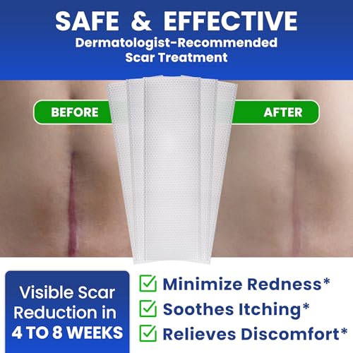 AWD Silicone Scar Sheets for Scar Removal - Extra Thick 0.5mm Silicone Scar Tape for Surgical Scars, C Section, Keloid - Silicone Skin Patches Extra Thick 0.5mm Longer Use (5 Pcs, 1.6” x 6”), Clear
