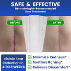 AWD Silicone Scar Sheets for Scar Removal - Extra Thick 0.5mm Silicone Scar Tape for Surgical Scars, C Section, Keloid - Silicone Skin Patches Extra Thick 0.5mm Longer Use (5 Pcs, 1.6” x 6”), Clear