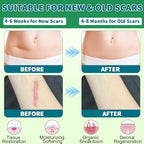 Silicone Scar Sheets, Silicone Scar Tape, Scar Sheets for Surgical Scars, Reusable Silicone Scar Strip For Surgical, C-Section,Tummy Tuck, Keloid Scars, Burn, Acne, Removal (1.6"X 108" Roll-3M)