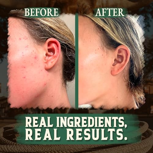 Wrath & Remedy Handmade Whipped Organic Beef Tallow for Skin - 4 OZ (Eucalyptus) — Grass Fed Beef Tallow Moisturizer and Honey Balm for Silky, Sensitive-Skin, Eczema, Rosacea - Free of Harsh Chemicals