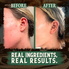 Wrath & Remedy Handmade Whipped Organic Beef Tallow for Skin - 4 OZ (Eucalyptus) — Grass Fed Beef Tallow Moisturizer and Honey Balm for Silky, Sensitive-Skin, Eczema, Rosacea - Free of Harsh Chemicals