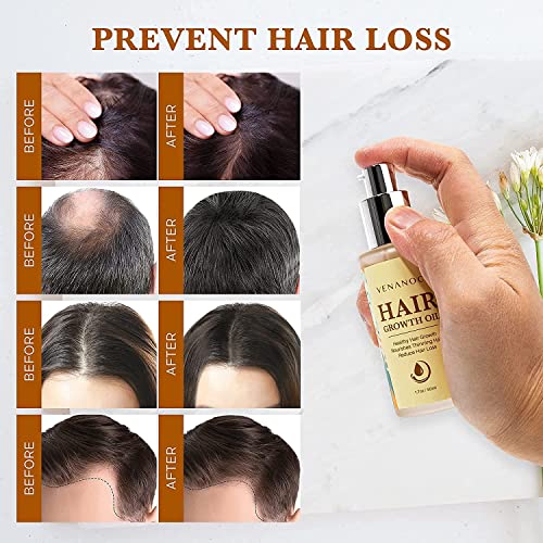 Veganic Natural Hair Growth Oil: Venanoci Hair Growth Serum with Biotin & Rosemary for Anti-Hair Loss, Hair Regrowth & Thickening – Strengthens & Nourishes Hair for Women & Men (2pcs)