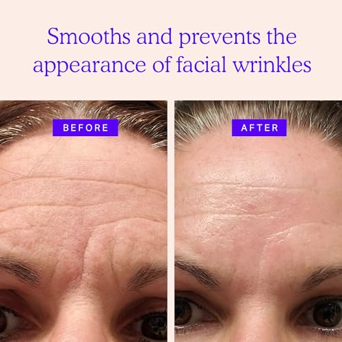 BLUMBODY Face & Forehead Wrinkle Patches - Mini Anti Wrinkle Facial Patches to Smooth Eye, Mouth, Forehead Wrinkles - Non-Silicone Face Tape for Fine Wrinkles between Eyes & Face - 160 Face Patches