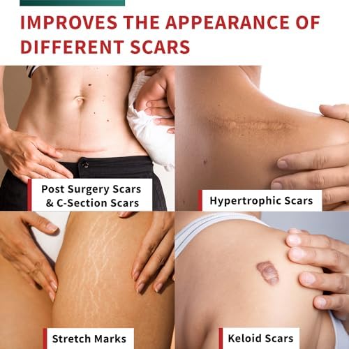 Medical-Grade Silicone Scar Tape Roll (1.6" x 118") Keloid Bump Removal Scar Sheets - Reusable Silicone Tape Scar Removal Strips, Scar Tape for Surgical Scars, C Section Scar Silicone Strips (2 Pack)