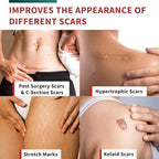 Medical-Grade Silicone Scar Tape Roll (1.6" x 118") Keloid Bump Removal Scar Sheets - Reusable Silicone Tape Scar Removal Strips, Scar Tape for Surgical Scars, C Section Scar Silicone Strips (2 Pack)