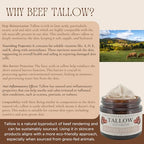 Grass-Fed Beef Tallow Eye Cream Infused with Coffee Beans - Rosehip Oil, Vitamin E - All Natural & Organic - Chemical Free - Non Toxic - Whipped - 1 oz Amber Glass Jar