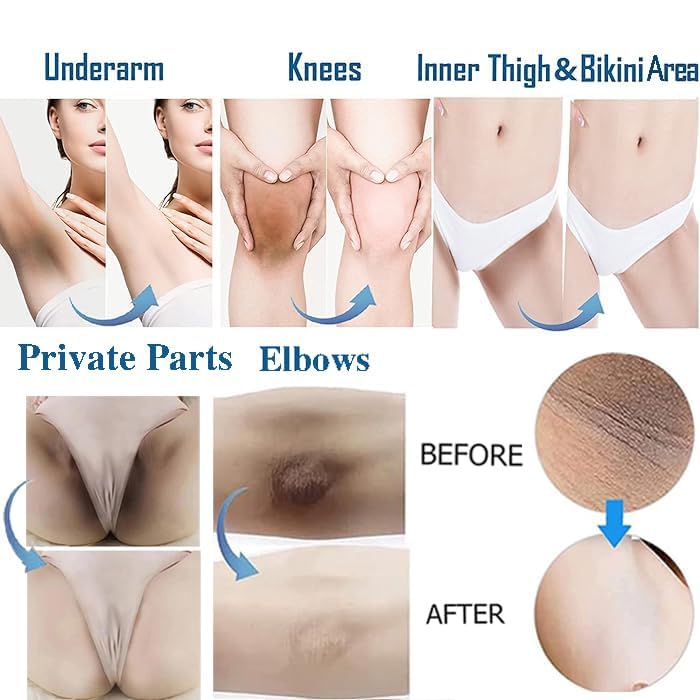 Intimate Areas Skin Lightening Cream Bleaching Cream For Body Sensitive Intimate Area, Private Parts, Underarm, Knees, Elbows, Inner Thigh, Bikini Areas, Bikini Line, Natural Skin Whitening.
