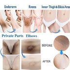 Intimate Areas Skin Lightening Cream Bleaching Cream For Body Sensitive Intimate Area, Private Parts, Underarm, Knees, Elbows, Inner Thigh, Bikini Areas, Bikini Line, Natural Skin Whitening.