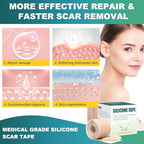 Silicone Scar Sheets (1.6" x 120" Roll-3M), Silicone Scar Tape for Scar Removal Treatment, Silicone Scar Removal Strips for Surgical, C-Section, Tummy Tuck, Keloid Bump Removal