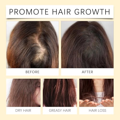 Batana Oil for Hair Growth, Liquid Batana Oil, with Rosemary, Castor, Pumpkin Seed, 4-In-1 Liquid Batana Oil, Organic Hair Oil for All Hair Types (1)