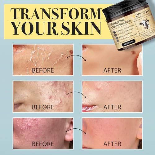 Beef Tallow Honey Balm for Skin:100% Grass-Fed Beef Tallow Moisturizer For Face and Body Vintage Tallow Balm With Olive Oil Manuka Honey For Sensitive Dry Skin Repair - 2 oz