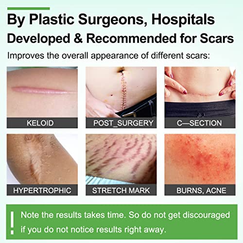 Silicone Scar Sheets, Tape, Strips, 16 Pcs 5.9"x1.6", Healing Keloid, C-Section, Tummy Tuck - As Surgical Cream, Gel, Patch, Bandage, Pad - Surgery Scars Treatment, Scar Remover.